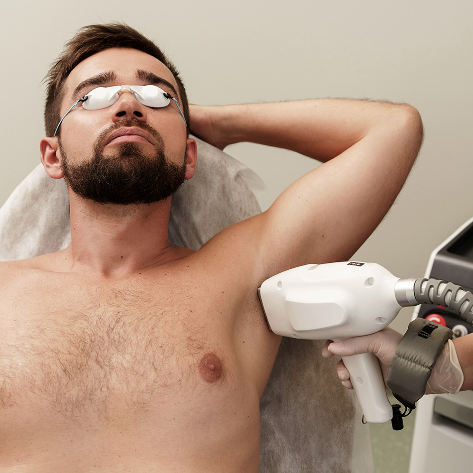 under arm Permanent Laser Hair Removal