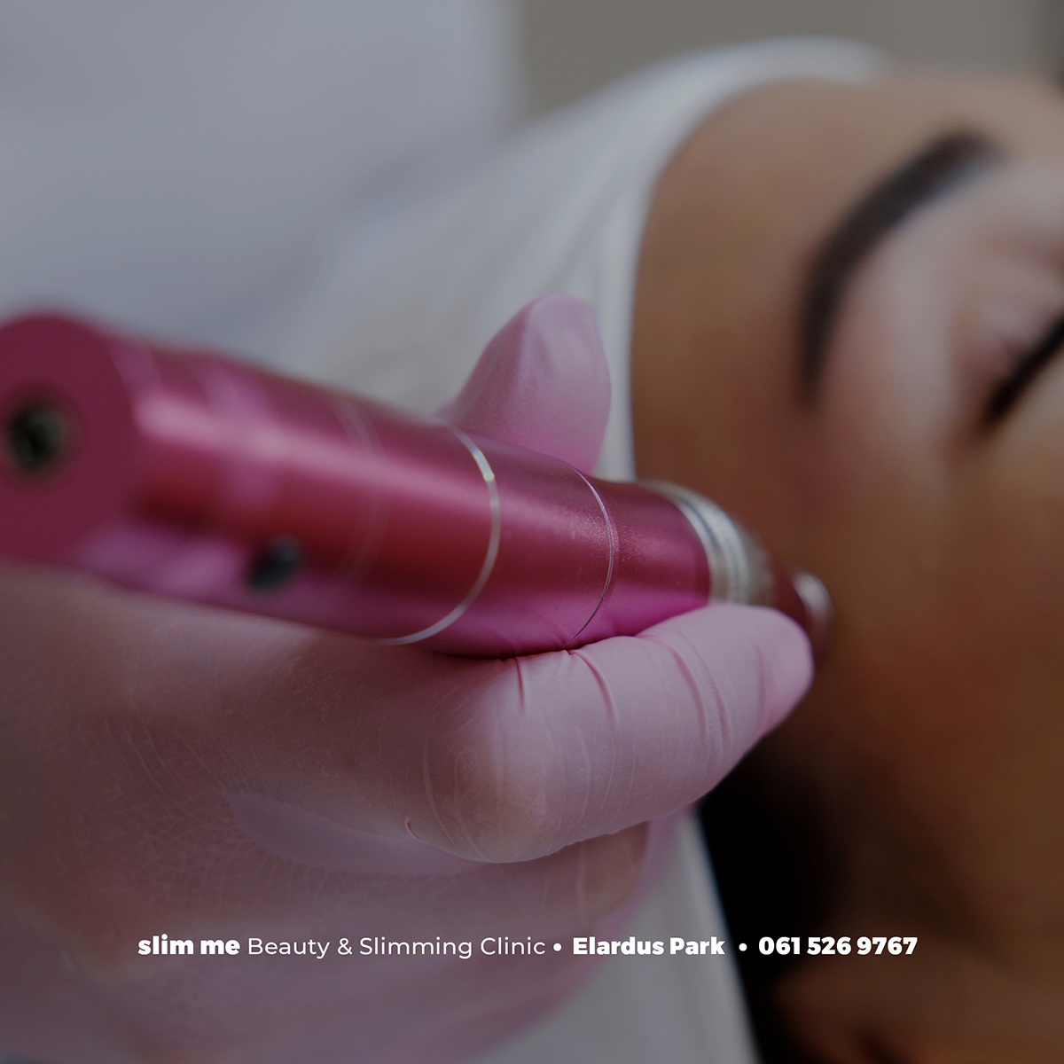 Micro-Needling | PROMO | Face & Neck - Image 3